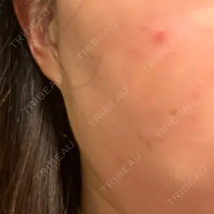 HELLATH CLINIC 新宿院口コミ