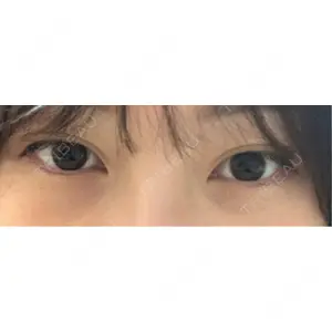 HAAB×DREAM BEAUTY CLINIC HAAB×DREAM BEAUTY CLINIC 大阪梅田院口コミ