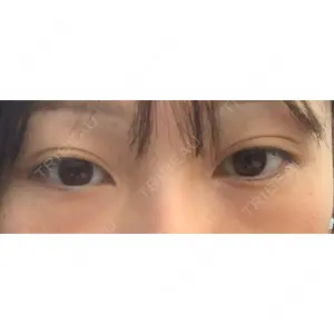HAAB×DREAM BEAUTY CLINIC HAAB×DREAM BEAUTY CLINIC 大阪梅田院口コミ