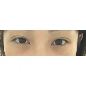 HAAB×DREAM BEAUTY CLINIC HAAB×DREAM BEAUTY CLINIC 大阪梅田院口コミ