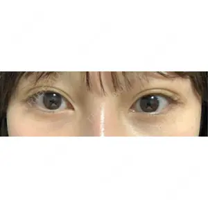 HAAB×DREAM BEAUTY CLINIC HAAB×DREAM BEAUTY CLINIC 大阪梅田院口コミ