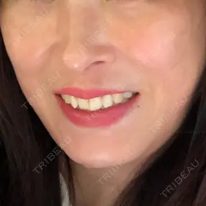 口コミ