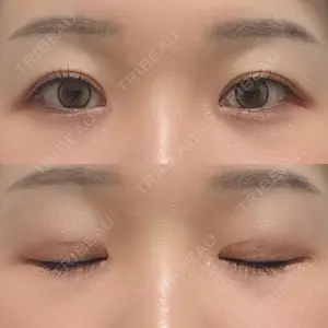 口コミ