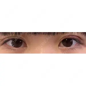 口コミ