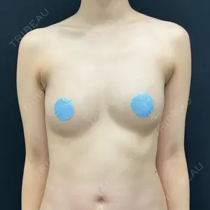 湘南美容クリニック 湘南美容クリニック 吉祥寺院口コミ