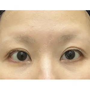 渋谷の森クリニック口コミ