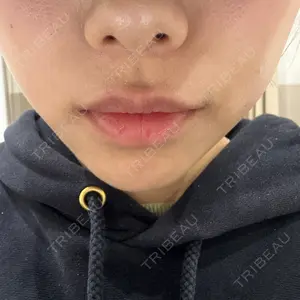 TCB東京中央美容外科 梅田茶屋町院口コミ