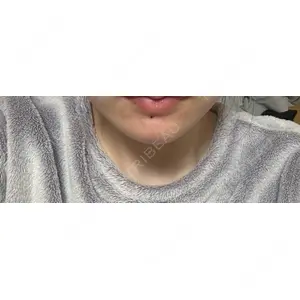 PRO CLINIC プロクリニック 銀座院口コミ