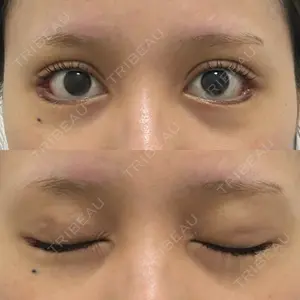HAAB×DREAM BEAUTY CLINIC HAAB×DREAM BEAUTY CLINIC 大阪梅田院口コミ