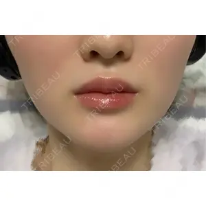 L‘amour clinic Tokyo【ラムールクリニック東京】口コミ