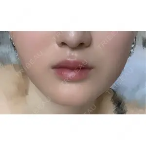 L‘amour clinic Tokyo【ラムールクリニック東京】口コミ