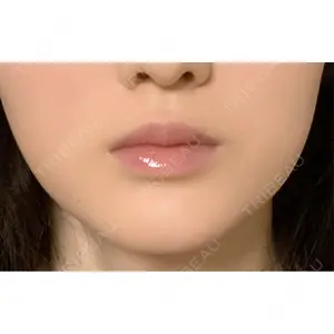 L‘amour clinic Tokyo【ラムールクリニック東京】口コミ