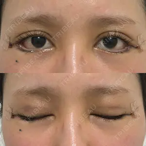 HAAB×DREAM BEAUTY CLINIC HAAB×DREAM BEAUTY CLINIC 大阪梅田院口コミ