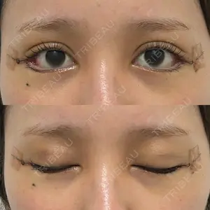 HAAB×DREAM BEAUTY CLINIC HAAB×DREAM BEAUTY CLINIC 大阪梅田院口コミ
