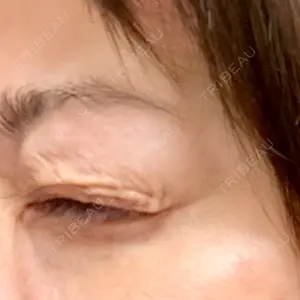 TCB東京中央美容外科 TCB東京中央美容外科 立川院口コミ