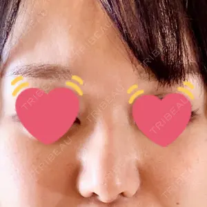 銀座マイアミ美容外科口コミ