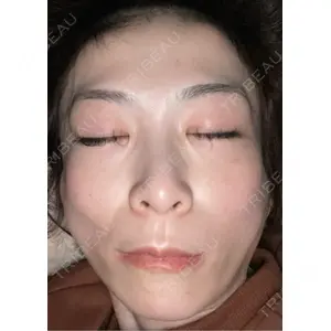 TCB東京中央美容外科 TCB東京中央美容外科 神戸院口コミ