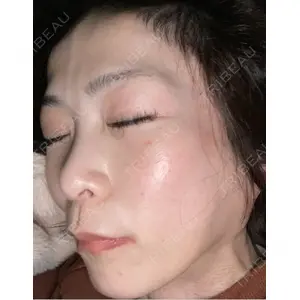 TCB東京中央美容外科 TCB東京中央美容外科 神戸院口コミ