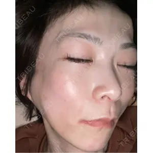 TCB東京中央美容外科 TCB東京中央美容外科 神戸院口コミ