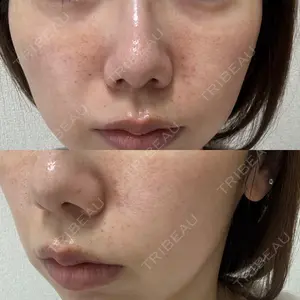 スマートスキンクリニック スマートスキンクリニック 神保町院口コミ