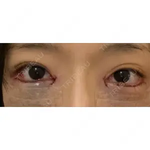 東京シンデレラ美容外科 東京シンデレラ美容外科 池袋院口コミ