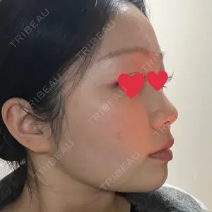 TCB東京中央美容外科 TCB東京中央美容外科 池袋駅前院口コミ