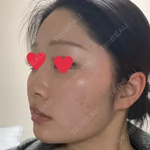 TCB東京中央美容外科 TCB東京中央美容外科 池袋駅前院口コミ