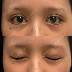 HAAB×DREAM BEAUTY CLINIC HAAB×DREAM BEAUTY CLINIC 大阪梅田院口コミ