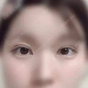 水の森美容クリニックの口コミ
