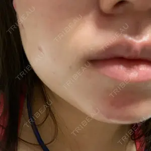L‘amour clinic Tokyo【ラムールクリニック東京】口コミ