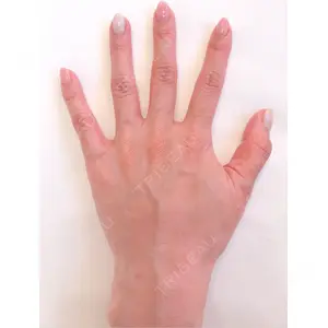 ヘアケアクリニック 六本木院口コミ