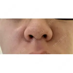TAクリニック グラントビューティクリニック 銀座院口コミ