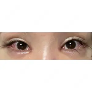 HAAB×DREAM BEAUTY CLINIC HAAB×DREAM BEAUTY CLINIC 大阪梅田院口コミ