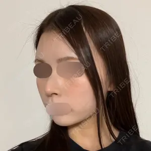 LUHO（ルホ）美容外科口コミ