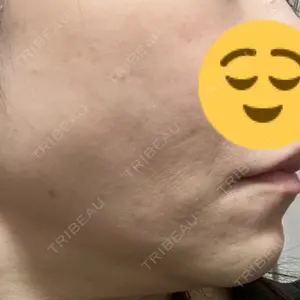 DMTC美容皮膚科 DMTC美容皮膚科 日本橋院口コミ