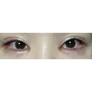HAAB×DREAM BEAUTY CLINIC HAAB×DREAM BEAUTY CLINIC 大阪梅田院口コミ