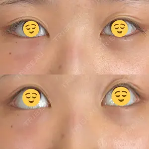 藤・ナチュレ美容クリニック 藤・ナチュレ美容クリニック 銀座院口コミ