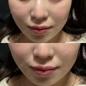 口コミ