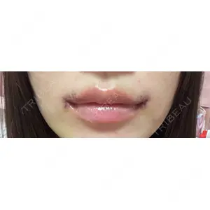 R Beauty CLINIC R Beauty CLINIC 銀座院口コミ
