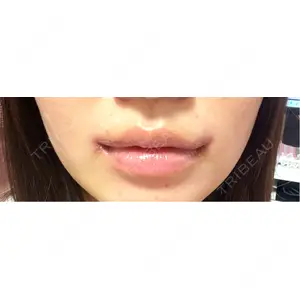 R Beauty CLINIC R Beauty CLINIC 銀座院口コミ