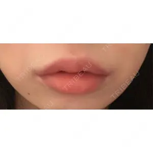 L‘amour clinic Tokyo【ラムールクリニック東京】の