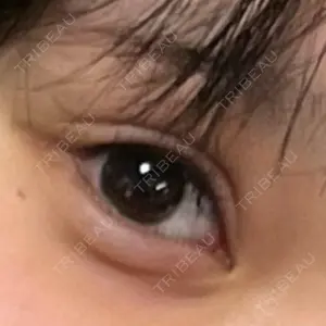 AI Beauty Clinic （エーアイ美容クリニック）口コミ