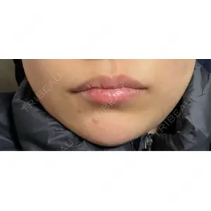 L‘amour clinic Tokyo【ラムールクリニック東京】口コミ