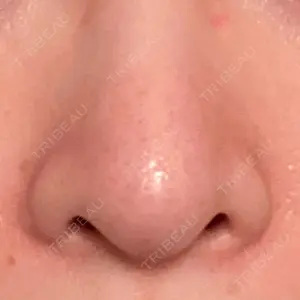 MIL CLINIC OSAKA口コミ