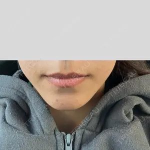 表参道スキンクリニックの口コミ