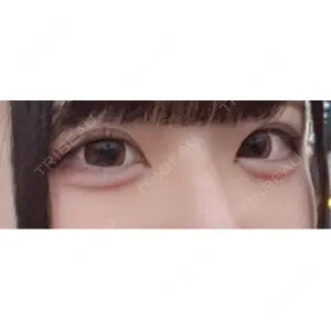 Olino美容外科・美容皮膚科口コミ