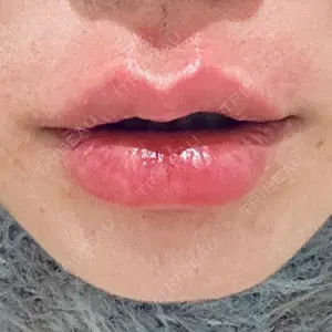 R Beauty CLINIC R Beauty CLINIC 銀座院口コミ