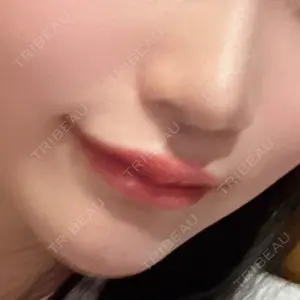 口コミ