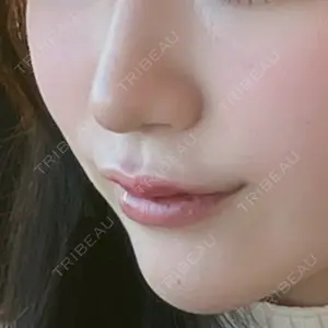 口コミ