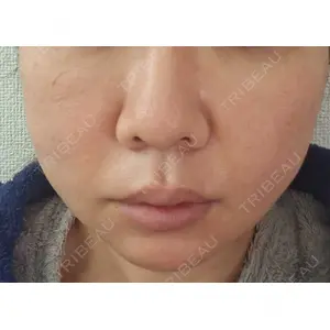 EMMO FACE CLINIC EMMO FACE CLINIC 東京三田院口コミ